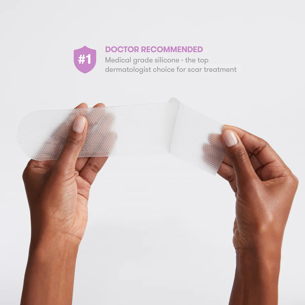 C Section Scar Patches - Yo Mama Maternity