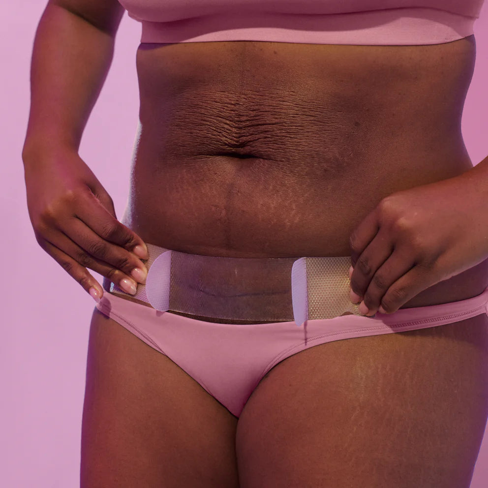 C Section Scar Patches - Yo Mama Maternity